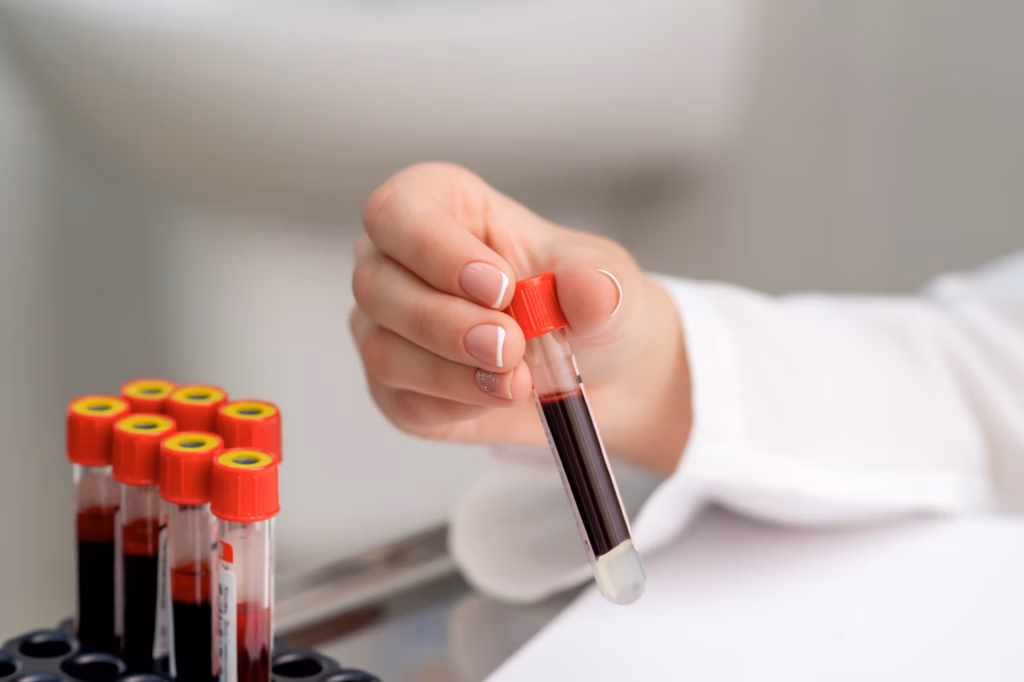 Eine Blutabnahme im Zuge des Check-ups 35.