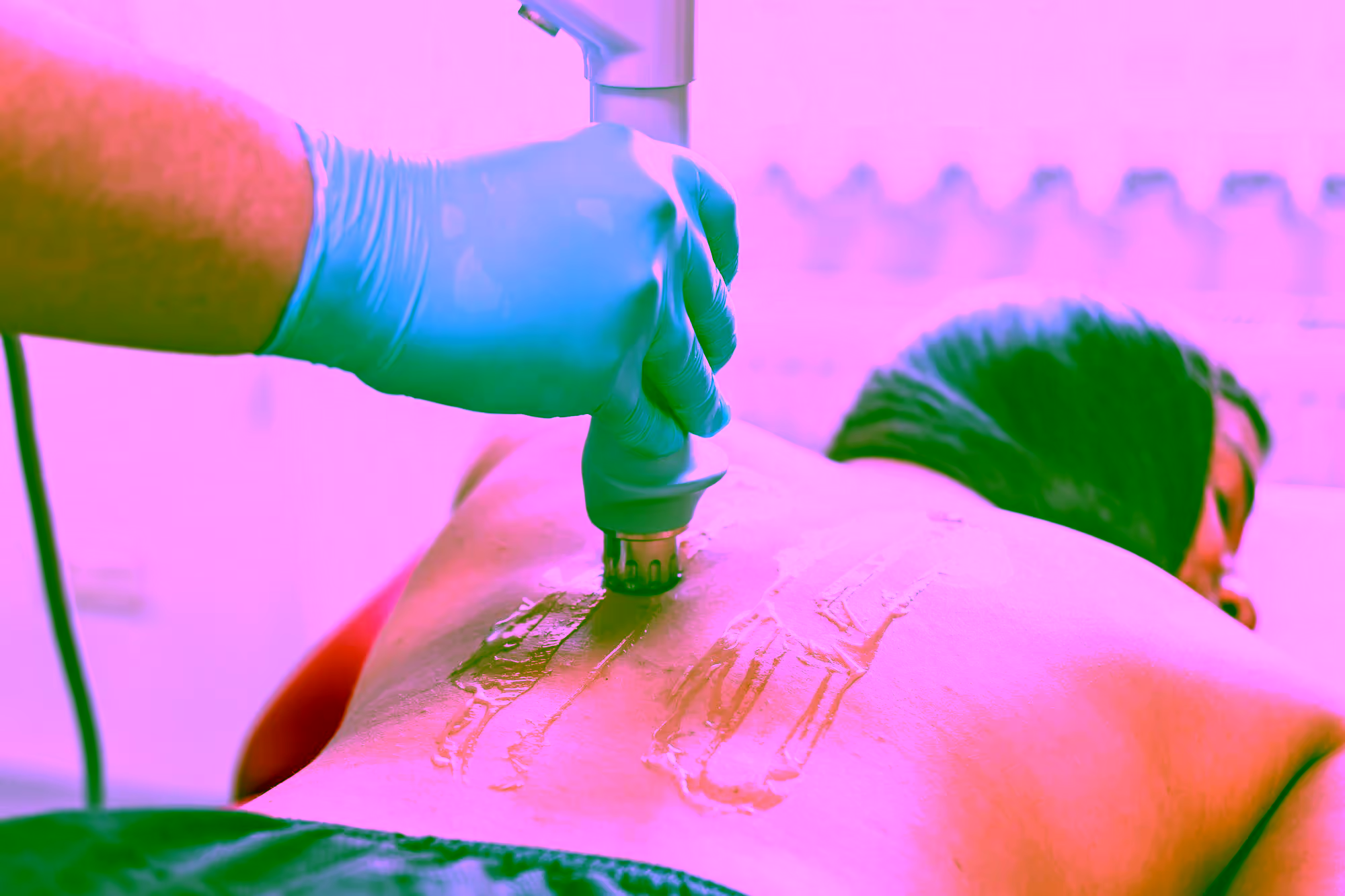 Stoßwellentherapie - Wie sie funktioniert und wann sie hilft