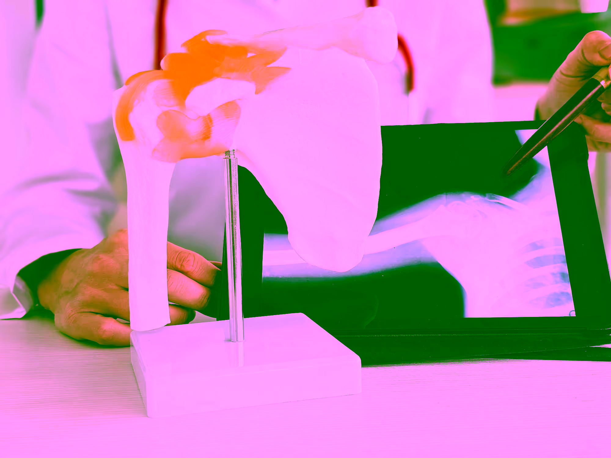 Vorbereitung für eine Schulterarthroskopie Ein Arzt erklärt einem Patientin die Schulteranatomie.