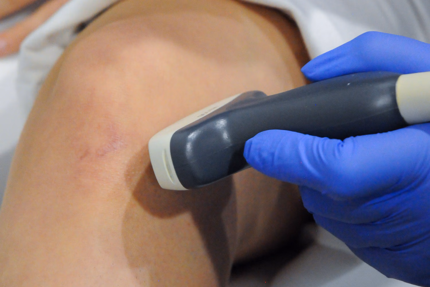 Wie gut wirkt Hyaluronsäure wirklich Ein Arzt behandelt das Knie eines Patienten mit einem Ultraschallgerät.